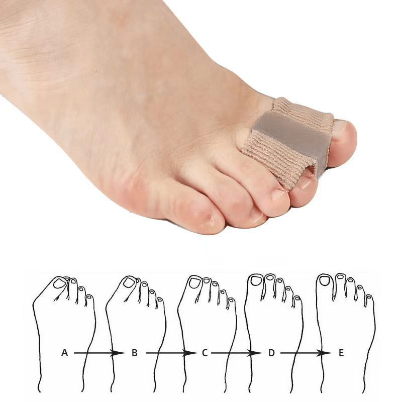Fiber Toe Separator - All The Above